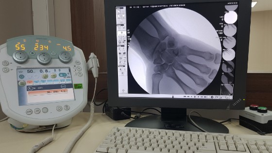 Shimadzu anjiyo kart tamiri